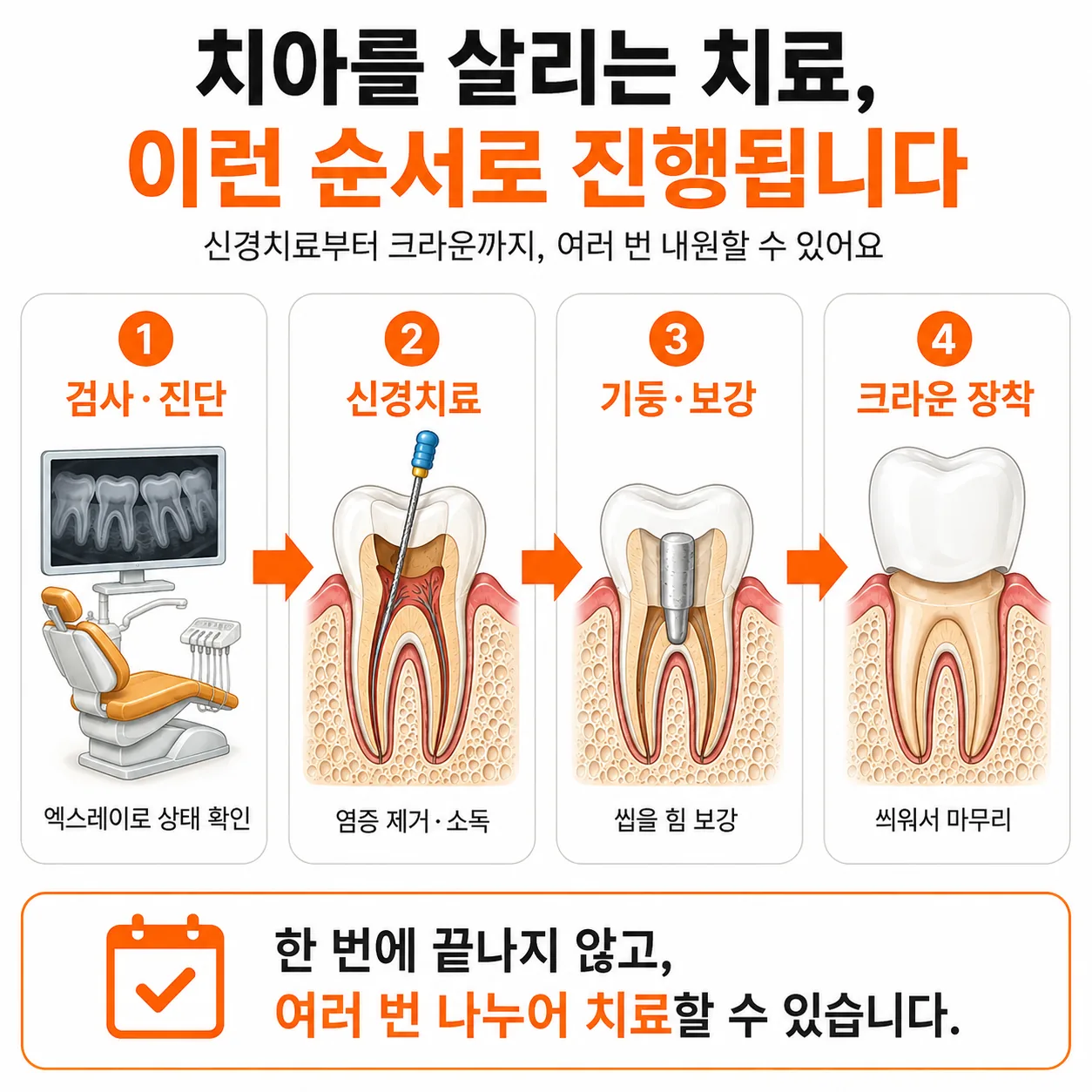 치아를 살리는 치료가 여러 번 내원으로 이어지는 단계 흐름