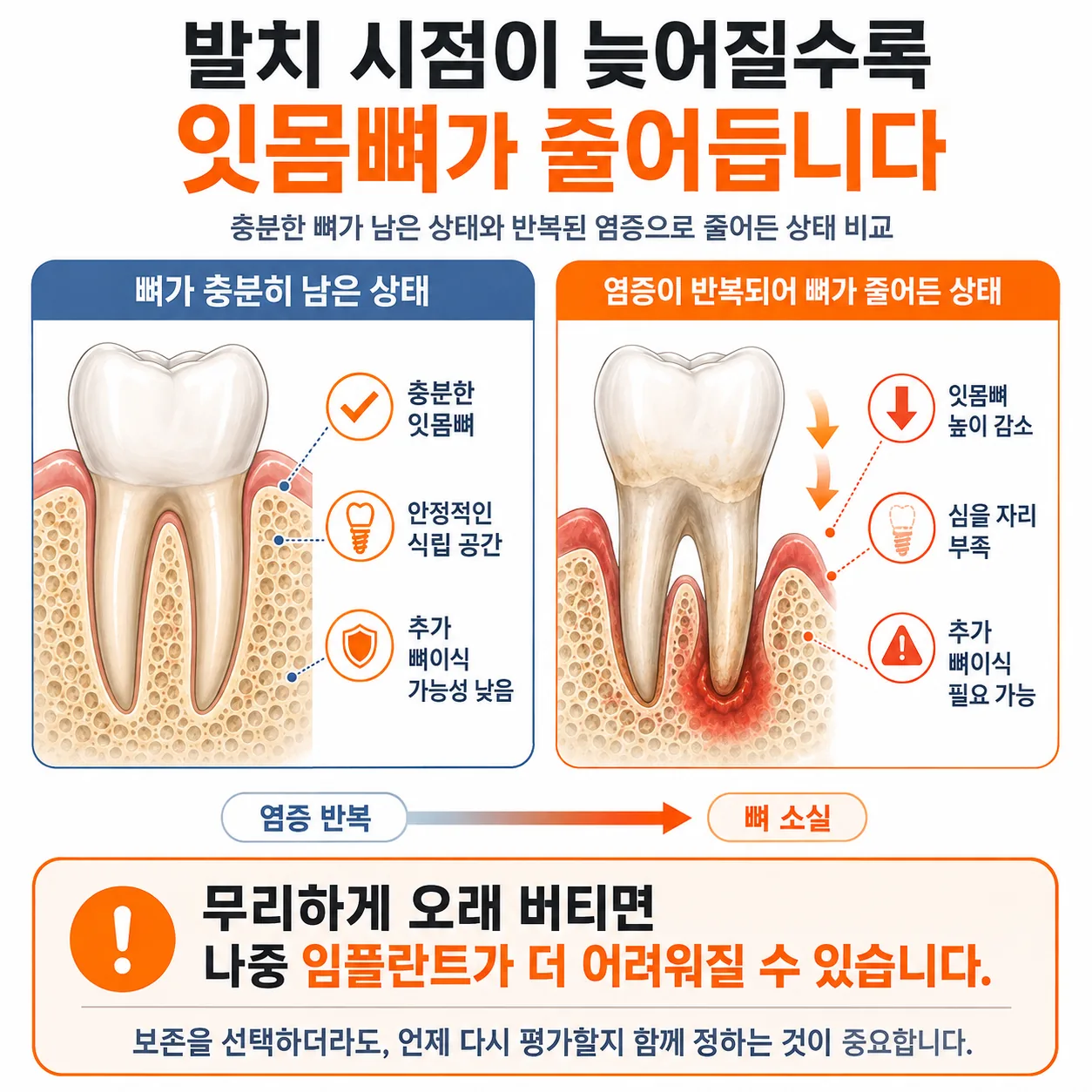 발치 시점이 늦어질수록 잇몸뼈가 줄어드는 변화 비교