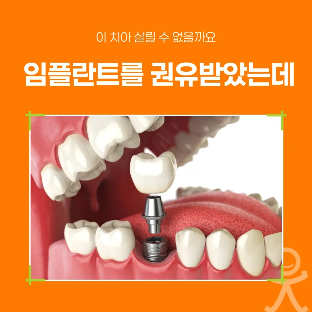 임플란트를 권유받았는데, 이 치아 살릴 수 없을까요