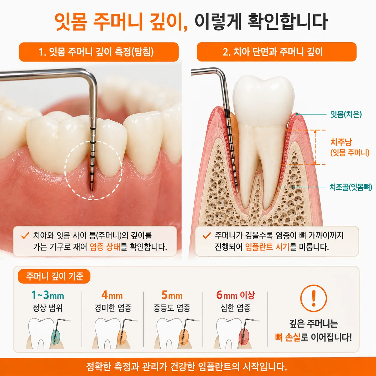 잇몸 주머니 깊이를 확인하는 재평가 과정 설명