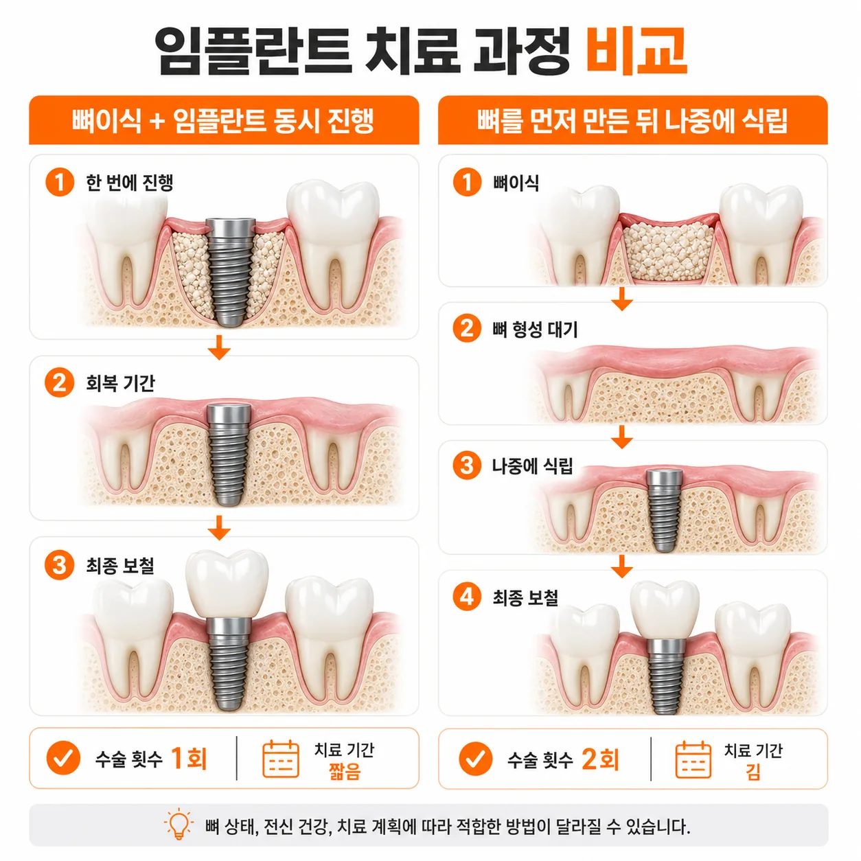 동시 식립과 단계 식립의 진행 순서를 비교한 흐름도