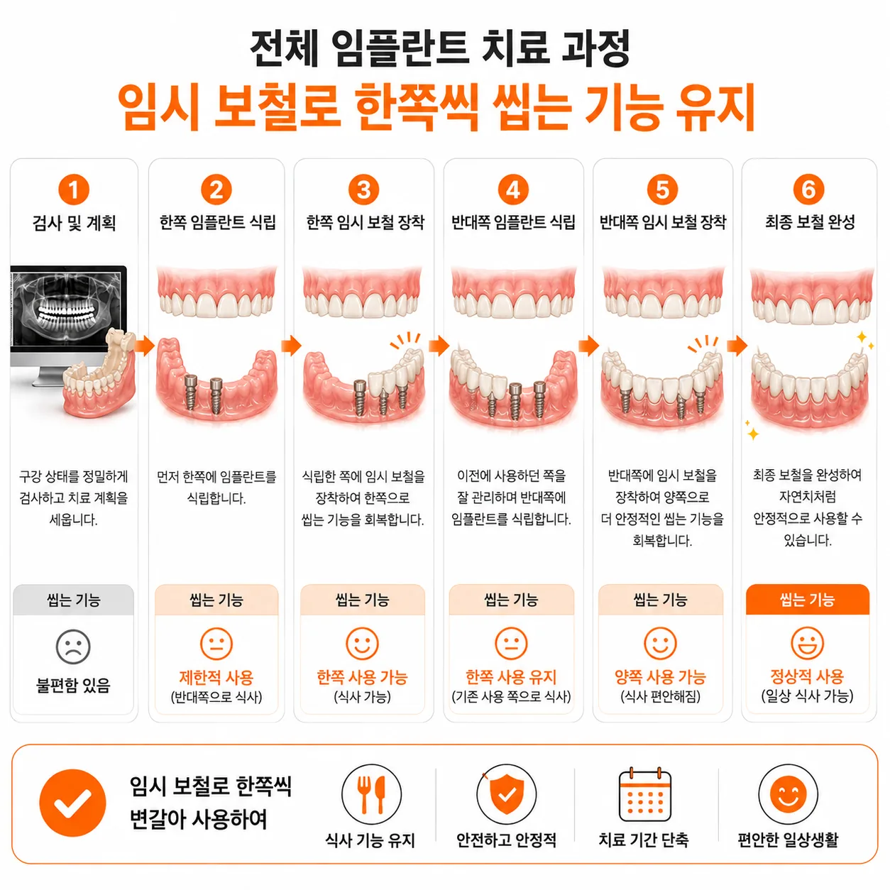 전체 임플란트 치료 중 임시 보철로 식사 기능을 유지하는 단계