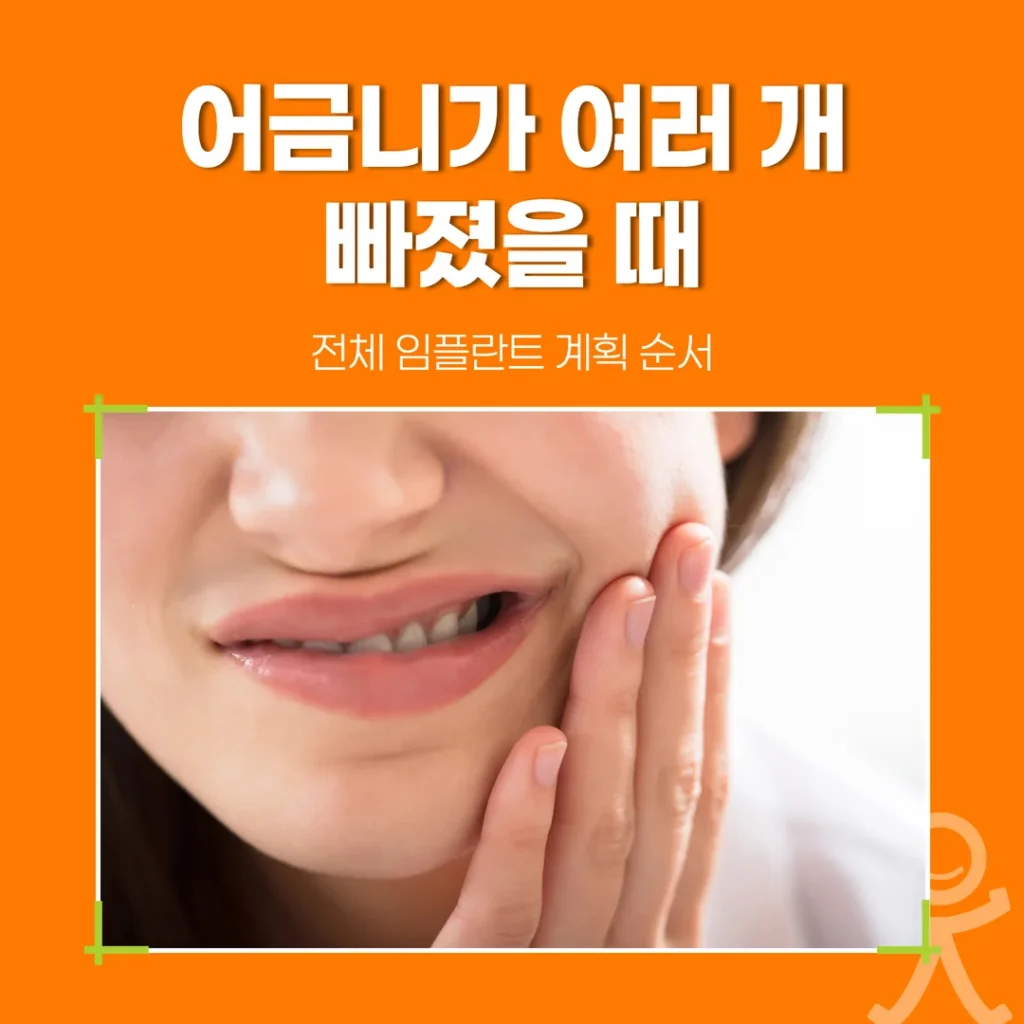 어금니가 여러 개 빠졌을 때, 전체 임플란트 계획 순서