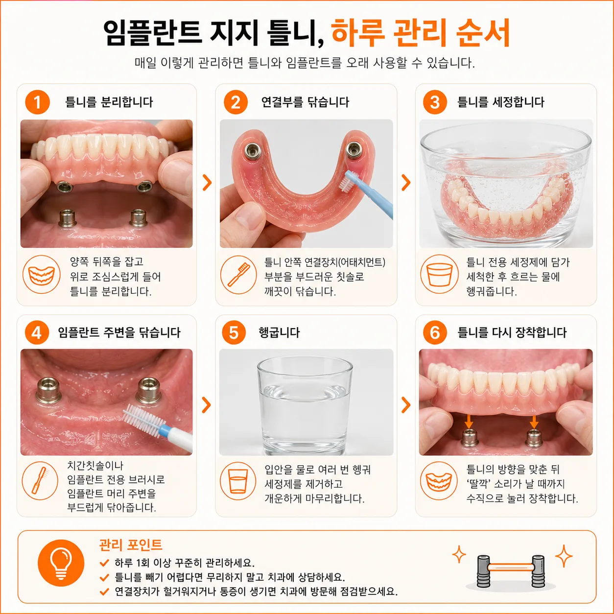 임플란트 지지 틀니의 하루 관리 순서