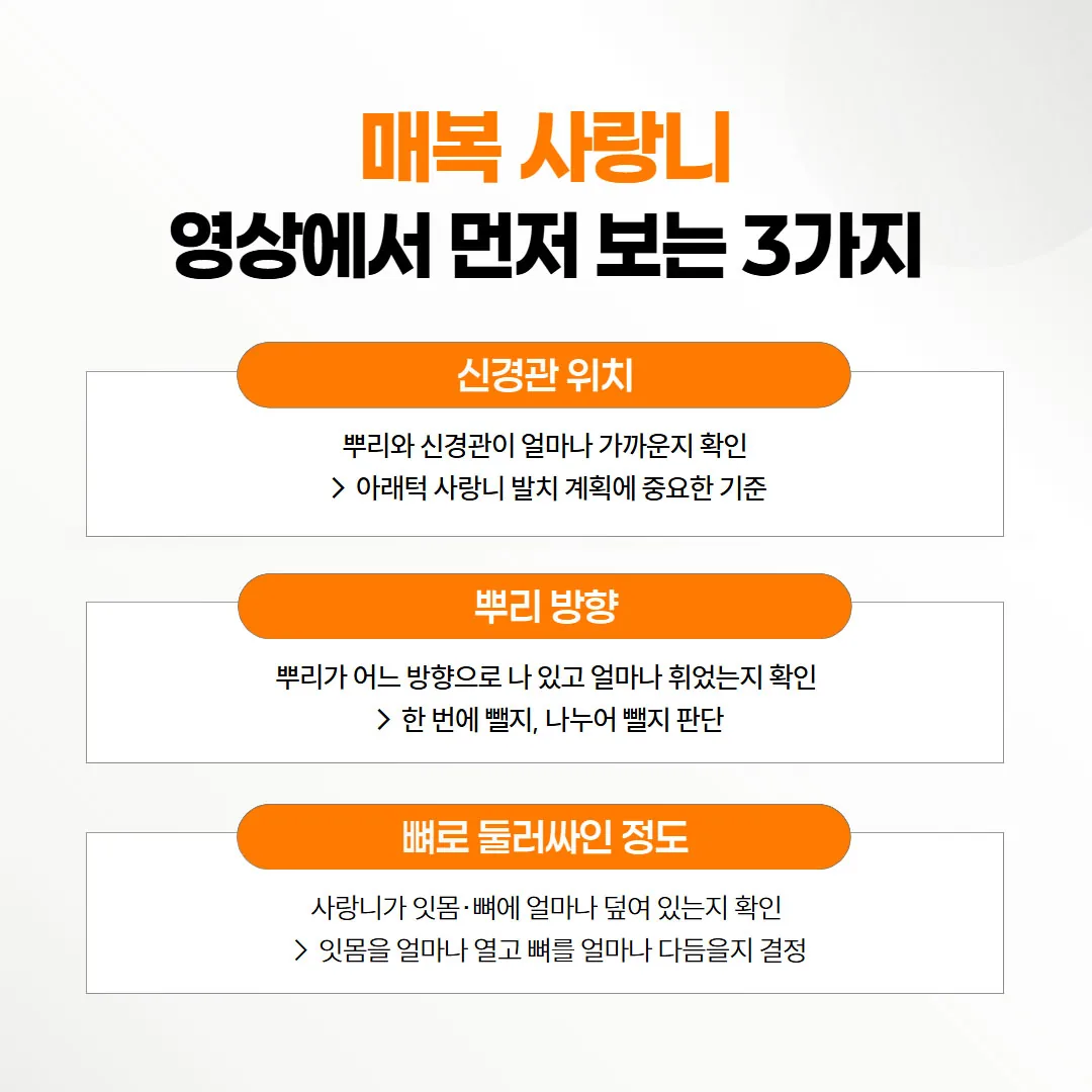매복 사랑니 영상에서 확인하는 세 가지 지점