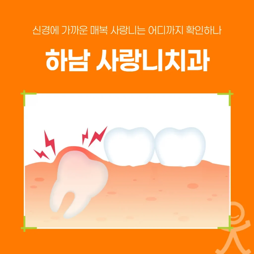 하남 사랑니치과, 신경에 가까운 매복 사랑니는 어디까지 확인하나
