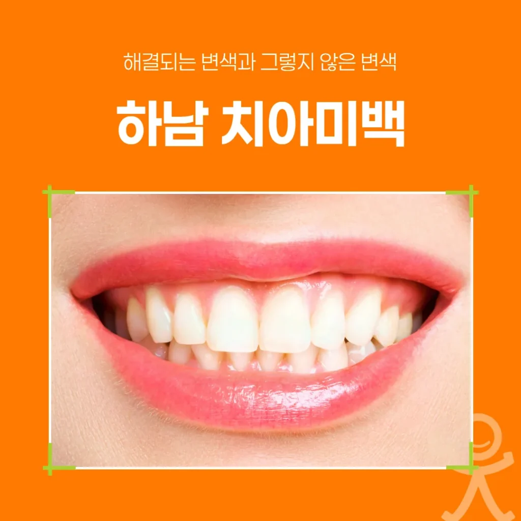 하남 치아미백, 해결되는 변색과 그렇지 않은 변색