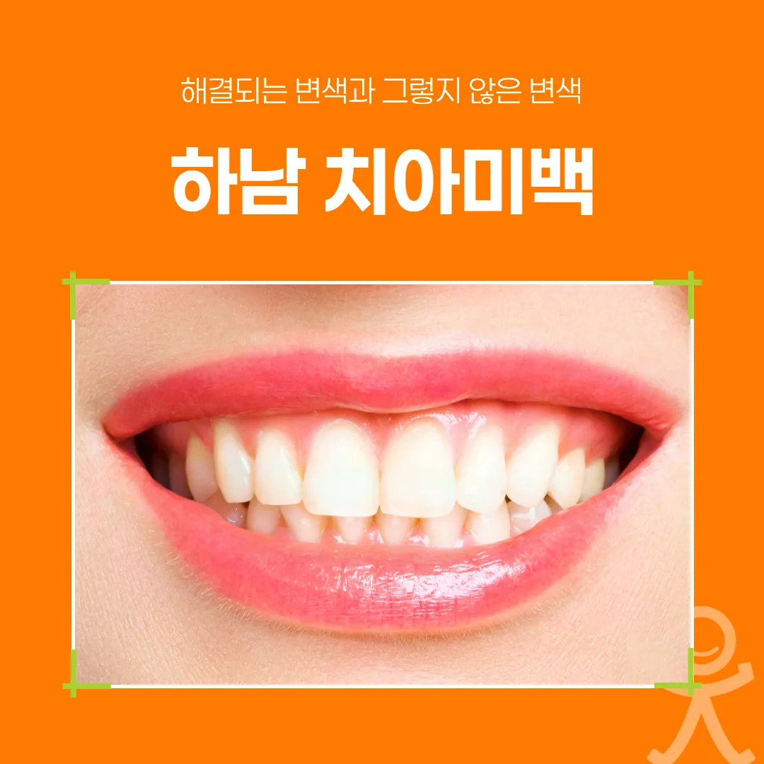 하남 치아미백, 해결되는 변색과 그렇지 않은 변색