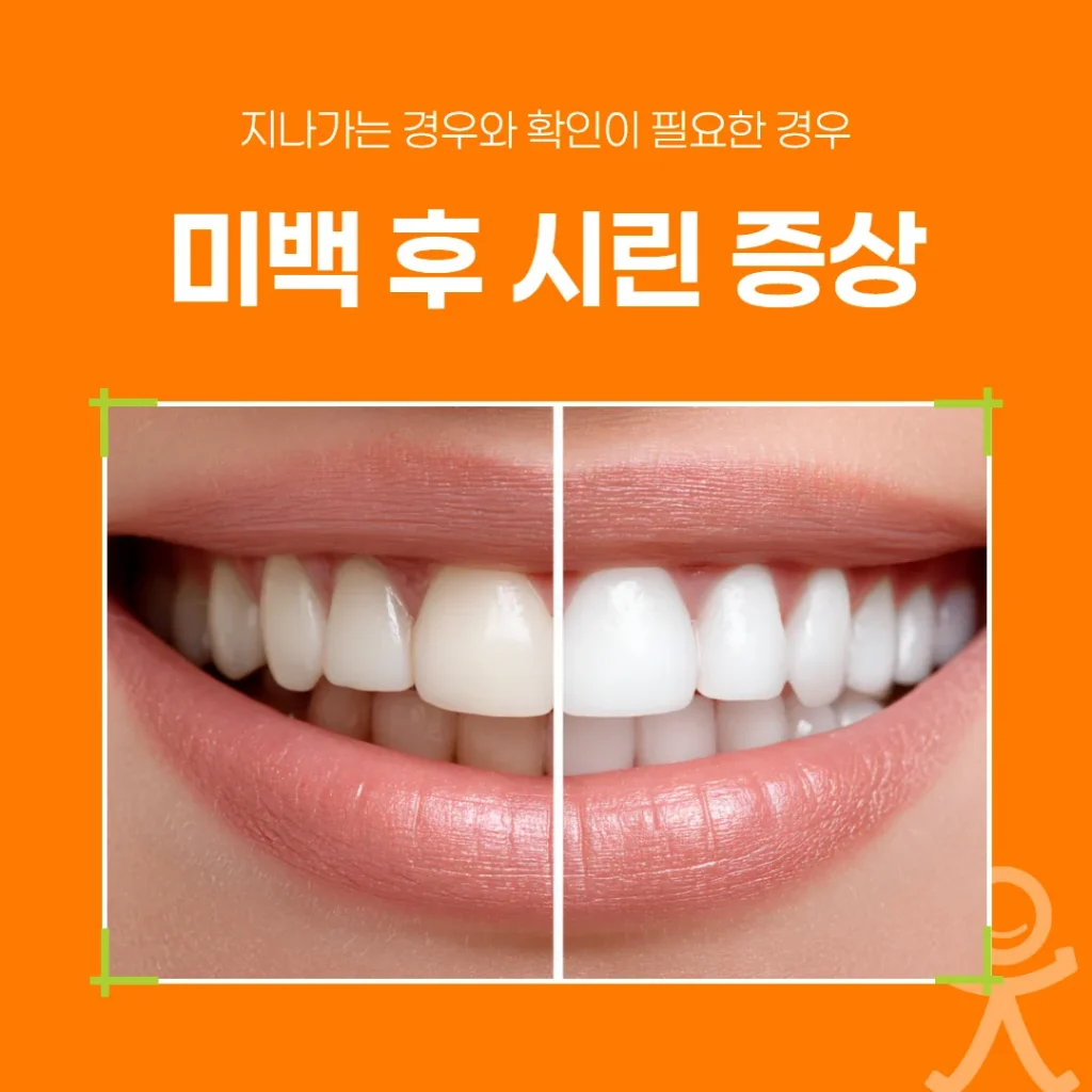 미백 후 시린 증상, 지나가는 경우와 확인이 필요한 경우