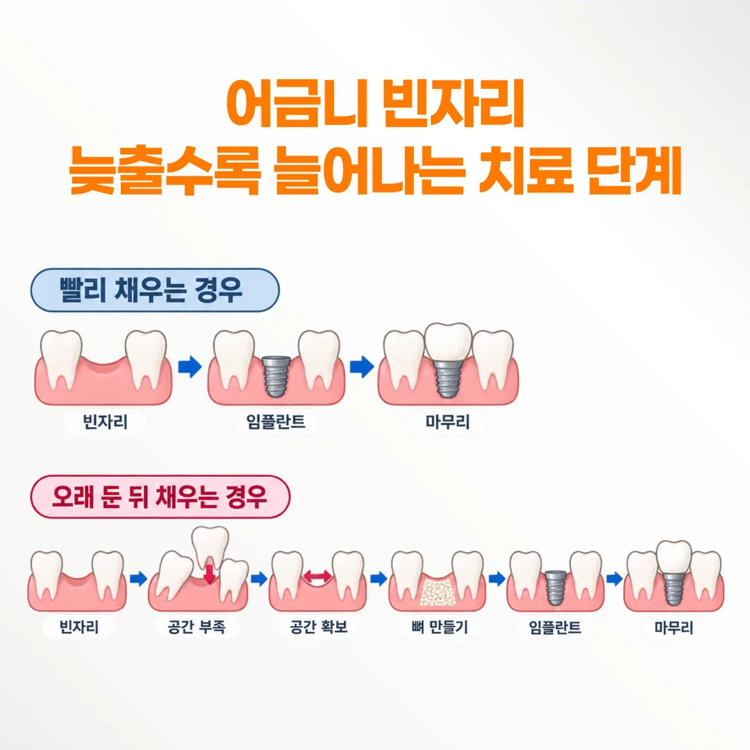 빠진 자리를 일찍 채울 때와 오래 둔 뒤 채울 때 치료 단계 수가 달라지는 흐름도