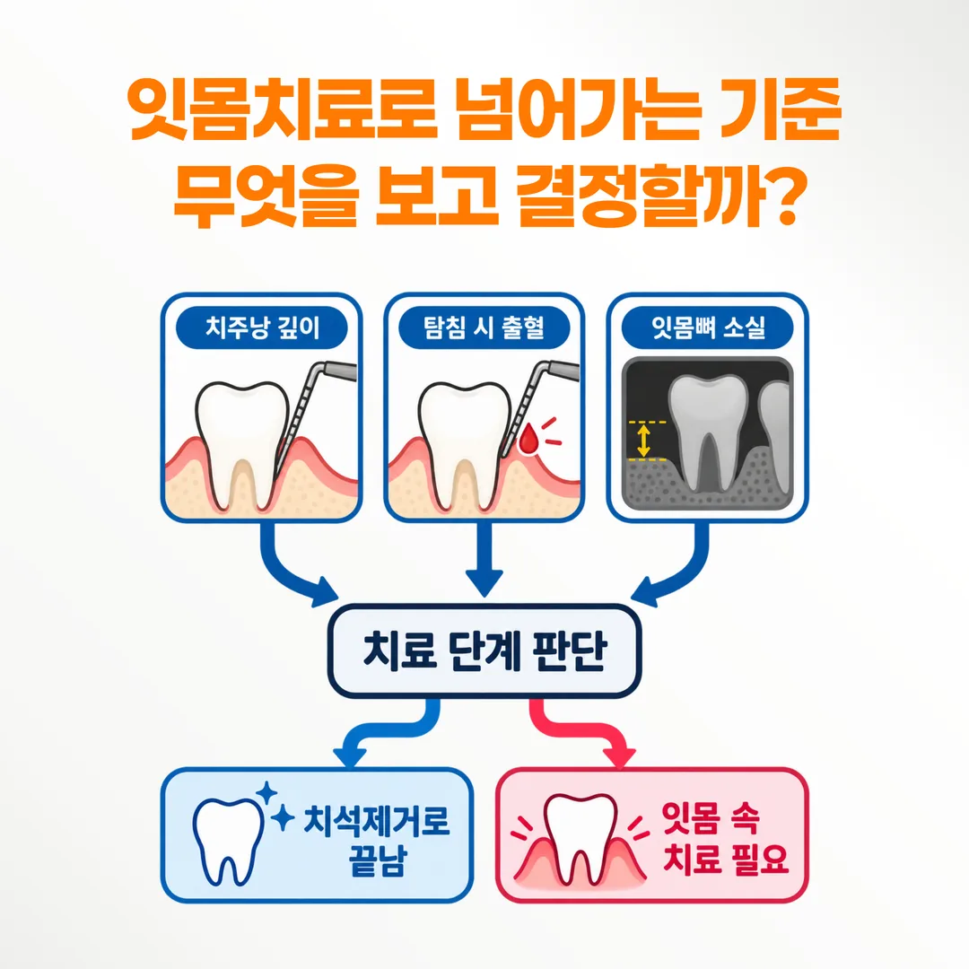 치주낭 깊이와 출혈, 잇몸뼈 소실을 함께 보고 치료 단계를 가르는 갈림 도표