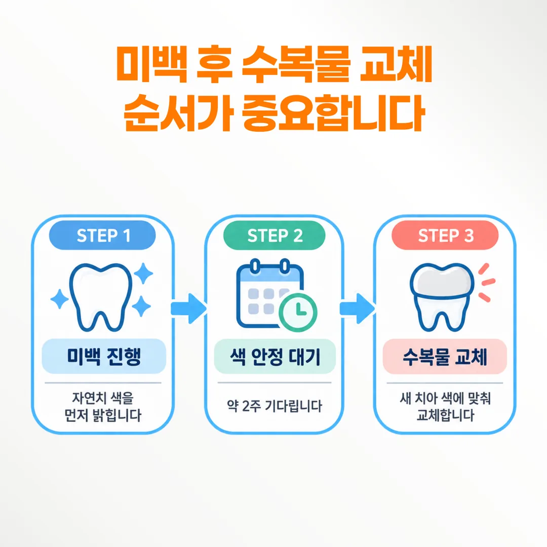 미백과 수복물 교체 순서를 시간 축에 놓은 일정도