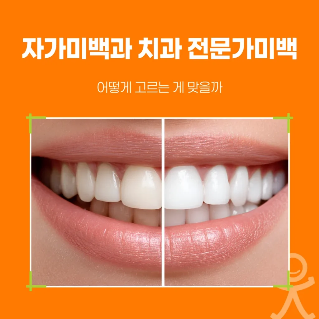 자가미백과 치과 전문가미백, 어떻게 고르는 게 맞을까