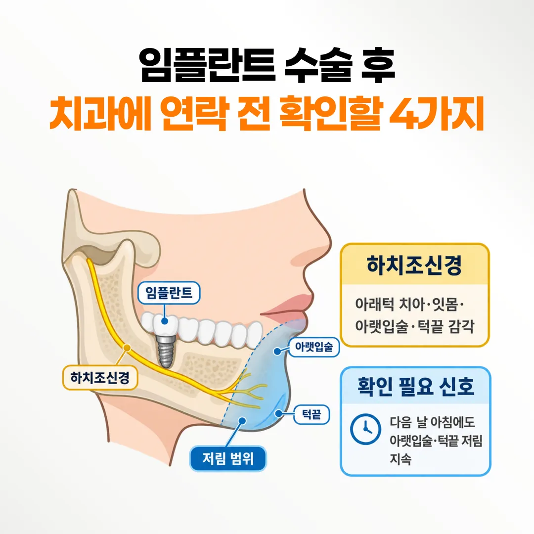 아래턱 임플란트 후 아랫입술과 턱끝에 저림이 나타나는 범위를 표시한 개념도