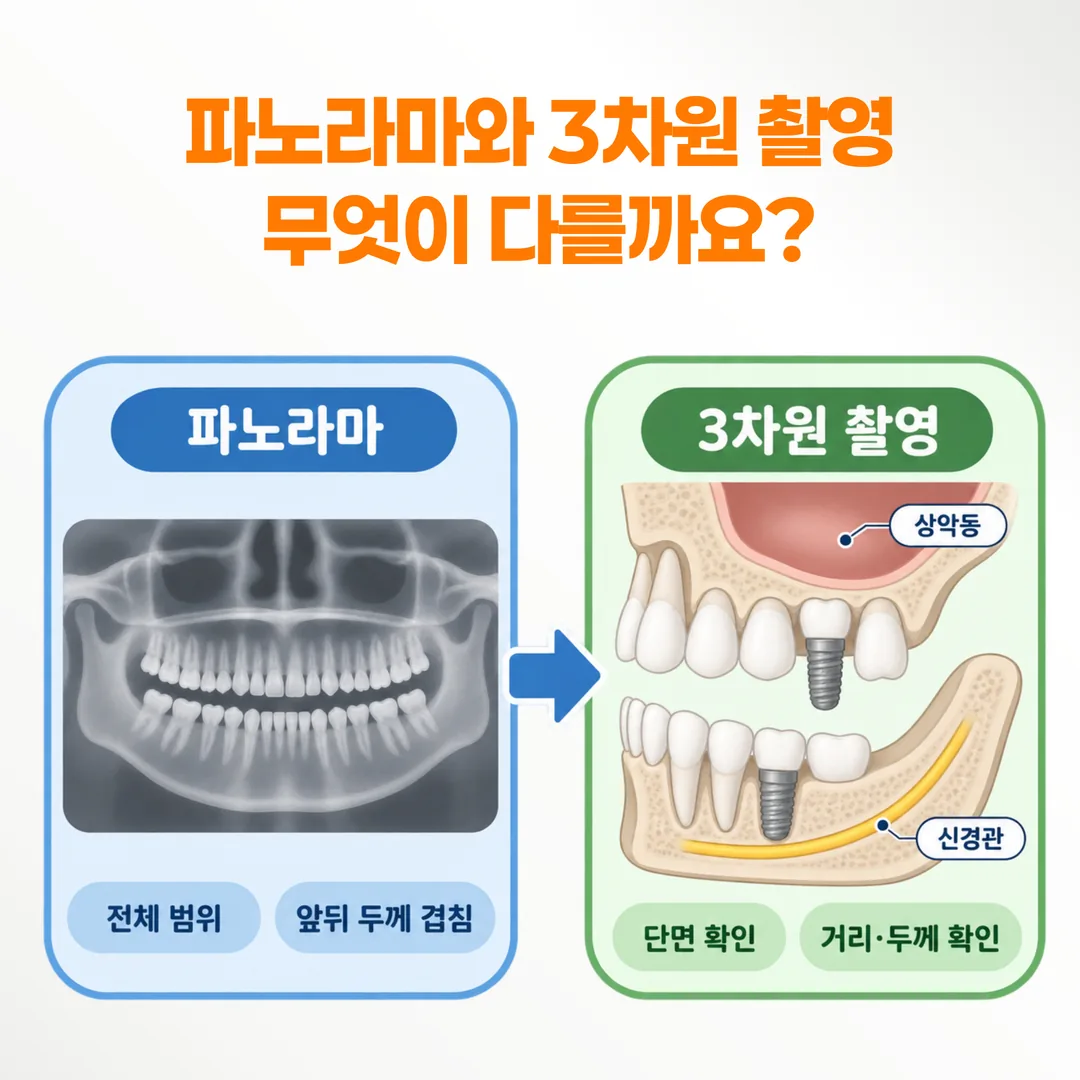파노라마 촬영과 삼차원 촬영이 각각 확인하는 범위 비교 개념도