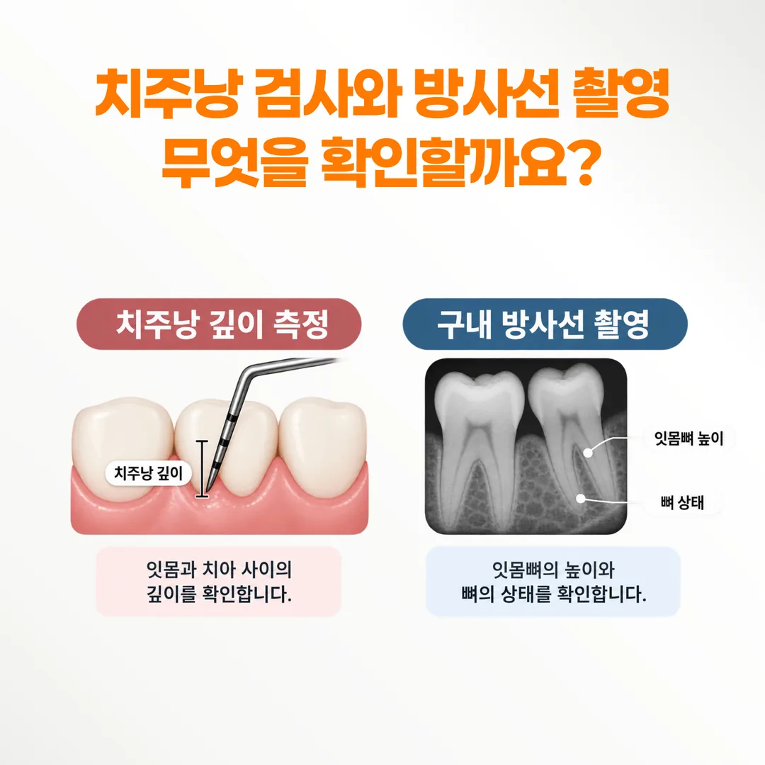 치주낭 깊이 측정과 구내 방사선 검사가 각각 확인하는 항목을 비교한 설명도