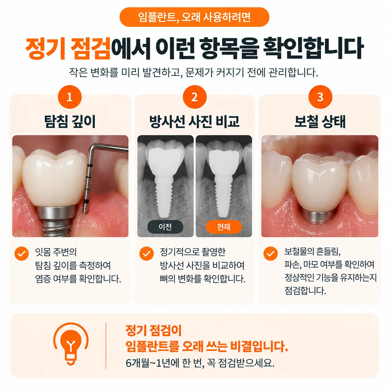 임플란트 정기 점검에서 확인하는 탐침 깊이와 방사선 사진 비교, 보철 상태 항목을 정리한 도식