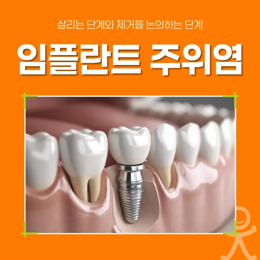 임플란트 주위염, 살리는 단계와 제거를 논의하는 단계