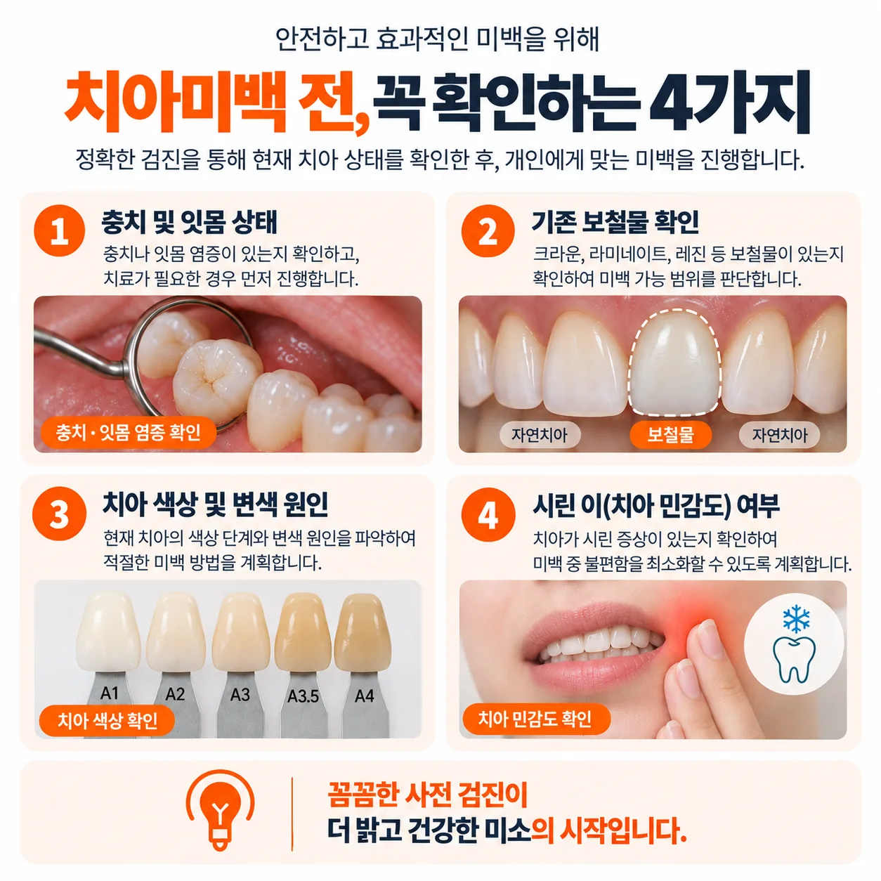 치아미백 시술 전 검진에서 확인하는 항목 개념도
