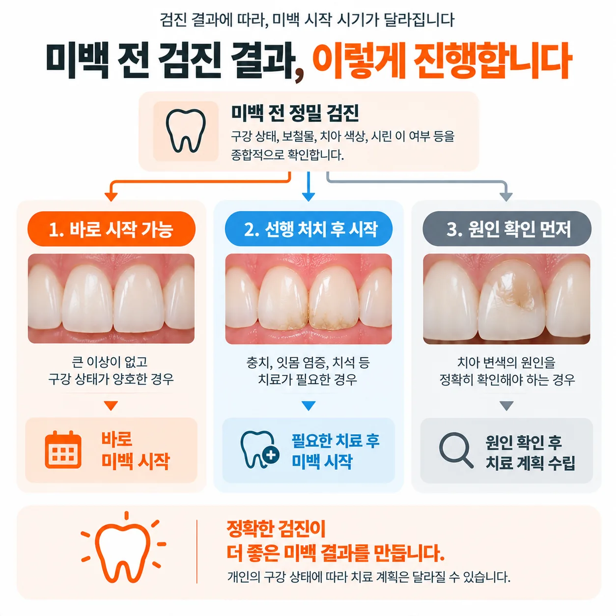 미백 전 검진 결과에 따라 나뉘는 세 가지 일정 분기도