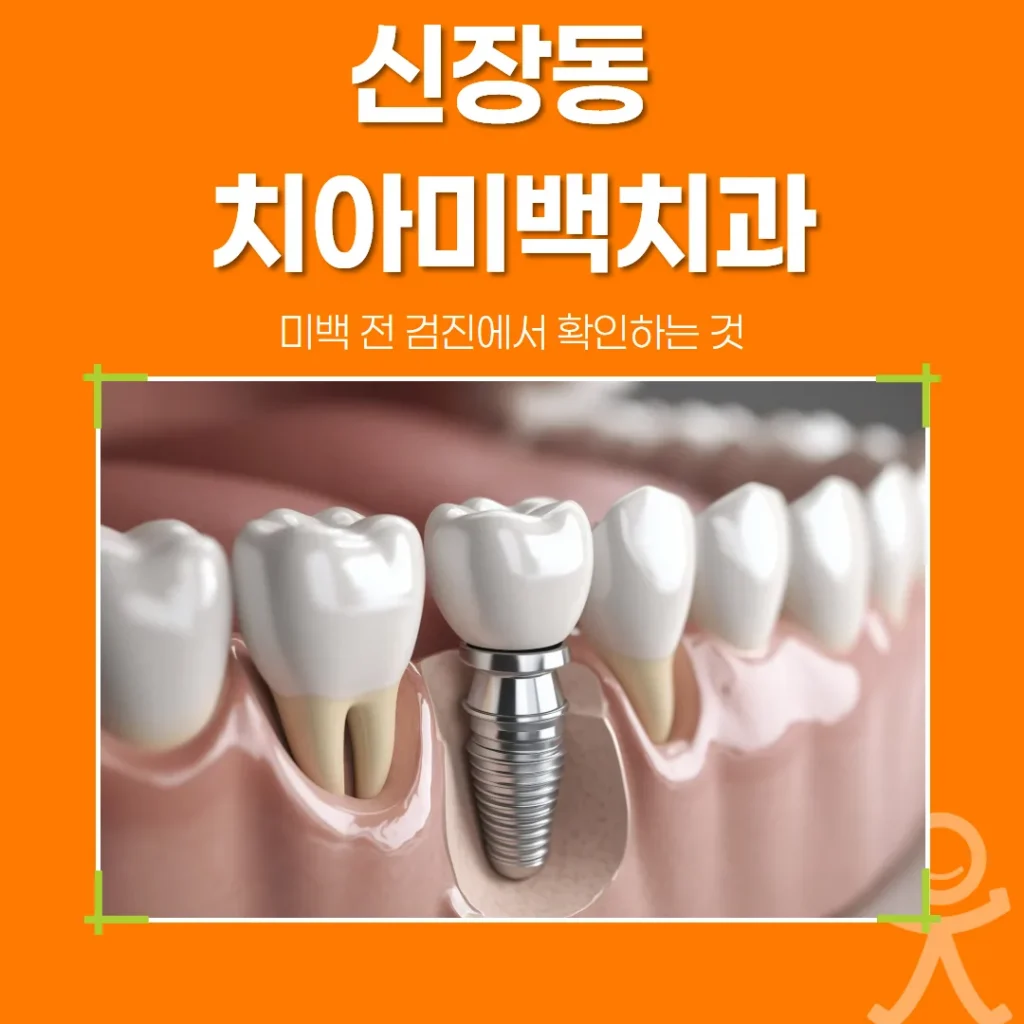 신장동 치아미백치과, 미백 전 검진에서 확인하는 것