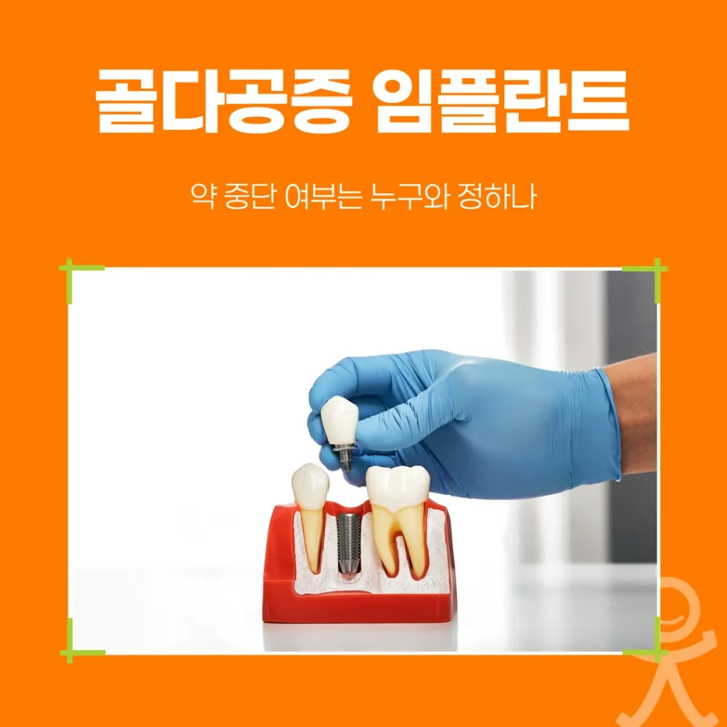 골다공증 임플란트, 약 중단 여부는 누구와 정하나