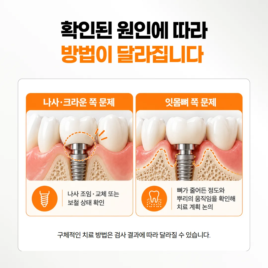 임플란트 흔들림의 나사 문제와 뼈 문제 이후 과정을 나란히 비교한 도식