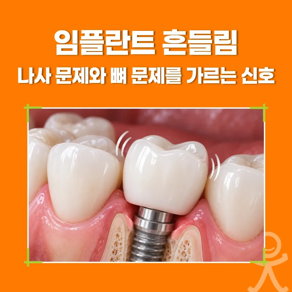 임플란트 흔들림, 나사 문제와 뼈 문제를 가르는 신호