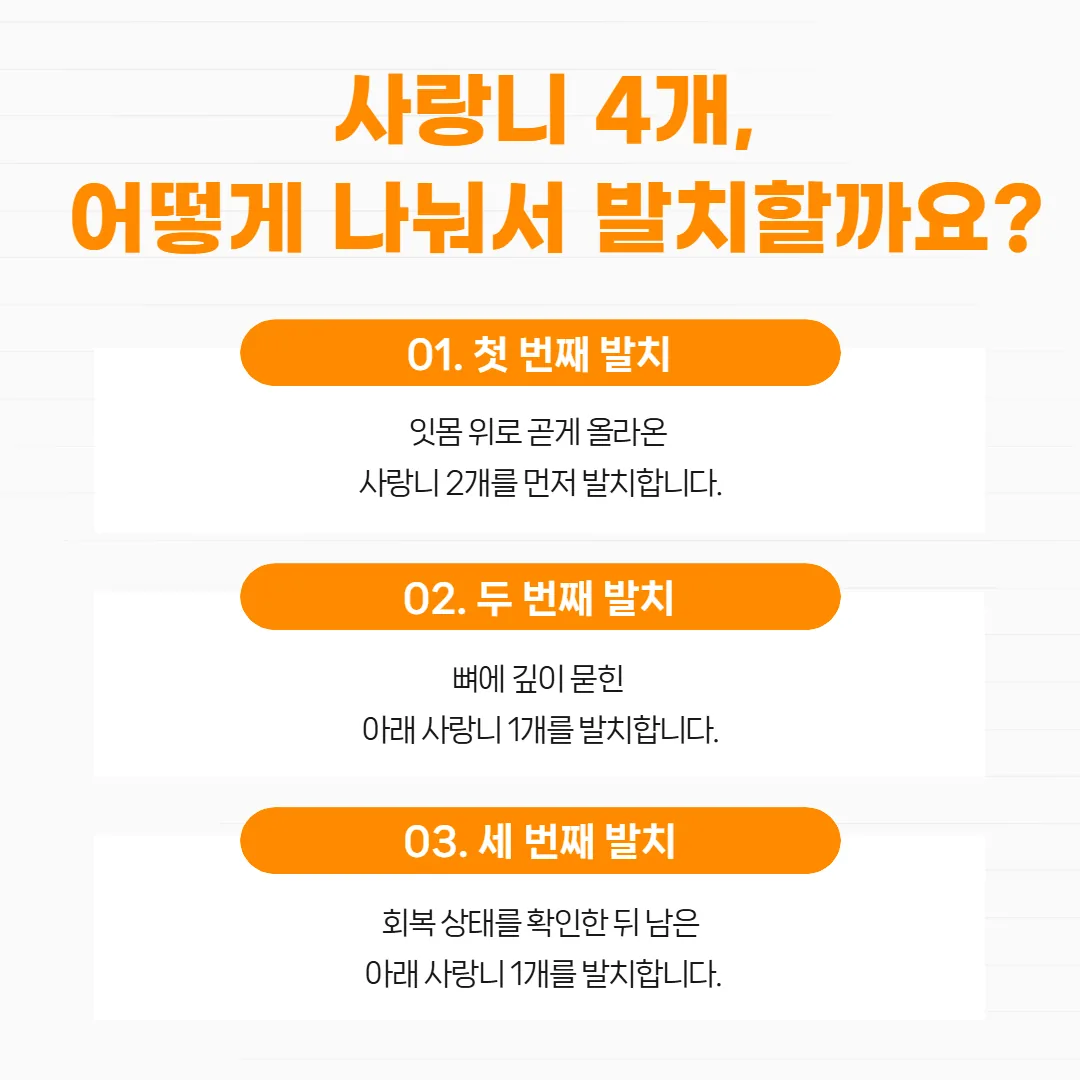 수월한 사랑니 두 개를 먼저 모으고 깊이 묻힌 아래 사랑니 두 개를 따로 잡는 세 번 나눔 계획표