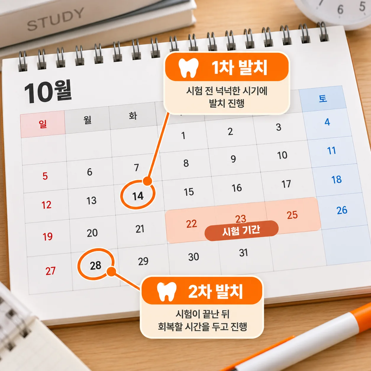 시험 기간을 피해 사랑니 발치 두 번의 날짜를 나눠 잡은 월간 계획표