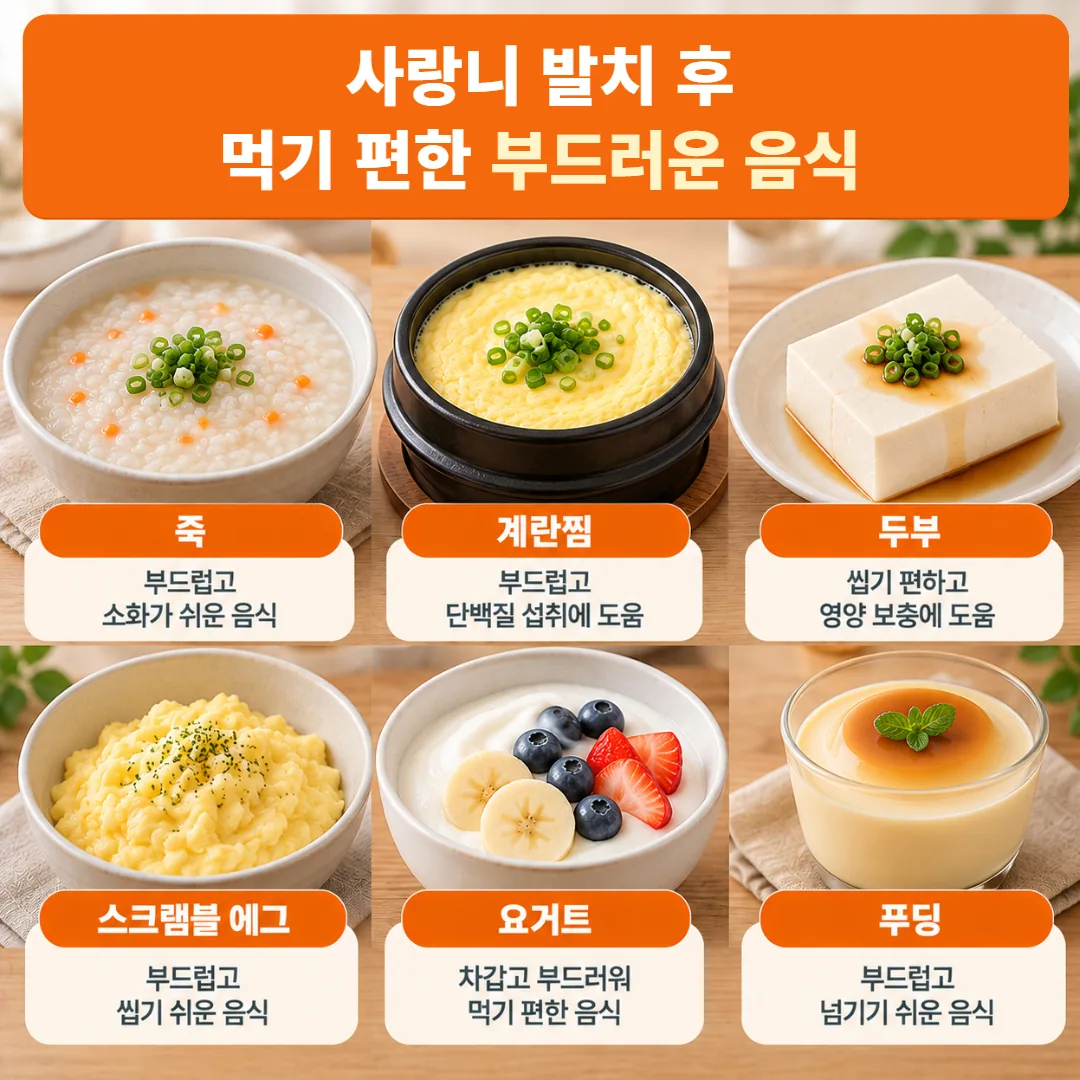 사랑니를 뽑은 뒤 며칠 동안 먹기 편한 무르고 순한 음식을 그린 식단 카드