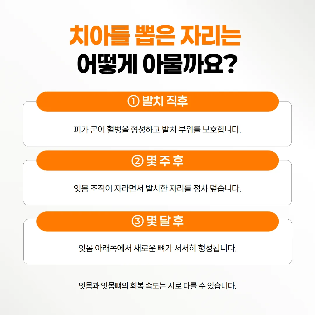 뽑은 자리에서 잇몸이 먼저 덮이고 잇몸뼈가 몇 달에 걸쳐 차오르는 순서를 보여 주는 단면 흐름도
