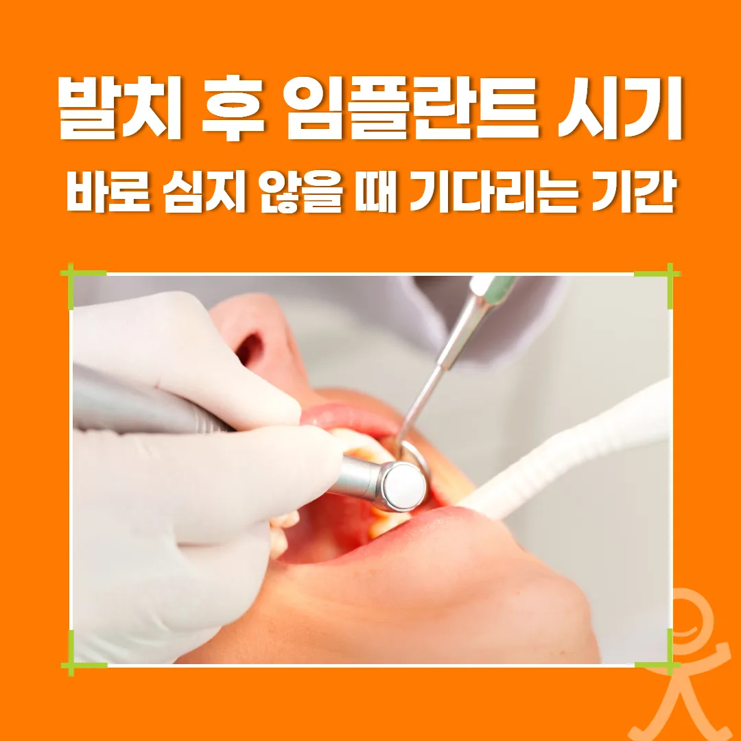 발치 후 임플란트 시기, 바로 심지 않을 때 기다리는 기간