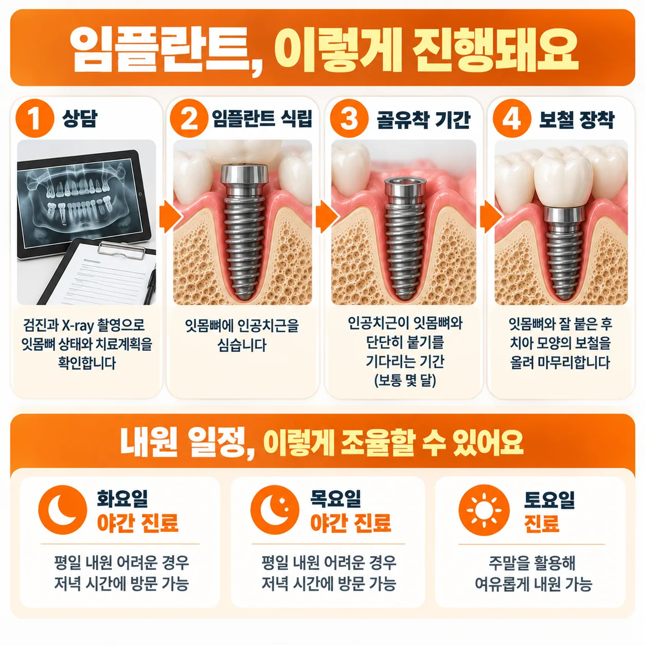 부모님 임플란트 내원 일정을 단계별로 표시한 달력 개념도
