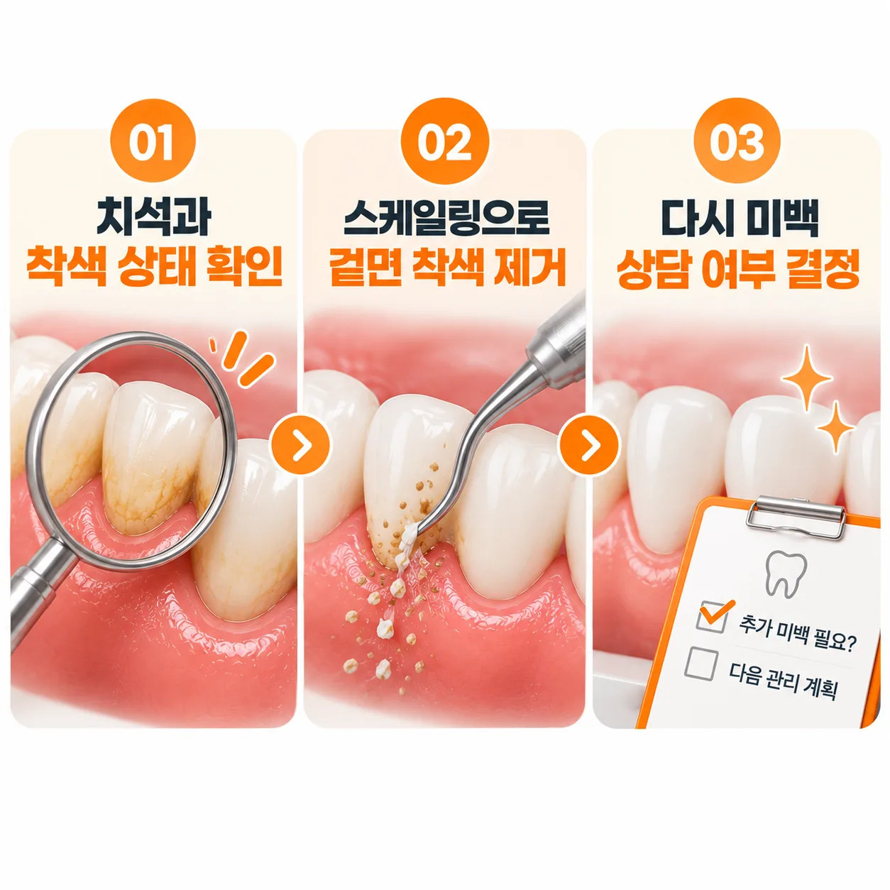 미백 뒤 정기 검진에서 치석과 겉면 착색을 살피고 다음 순서를 정하는 흐름 도식