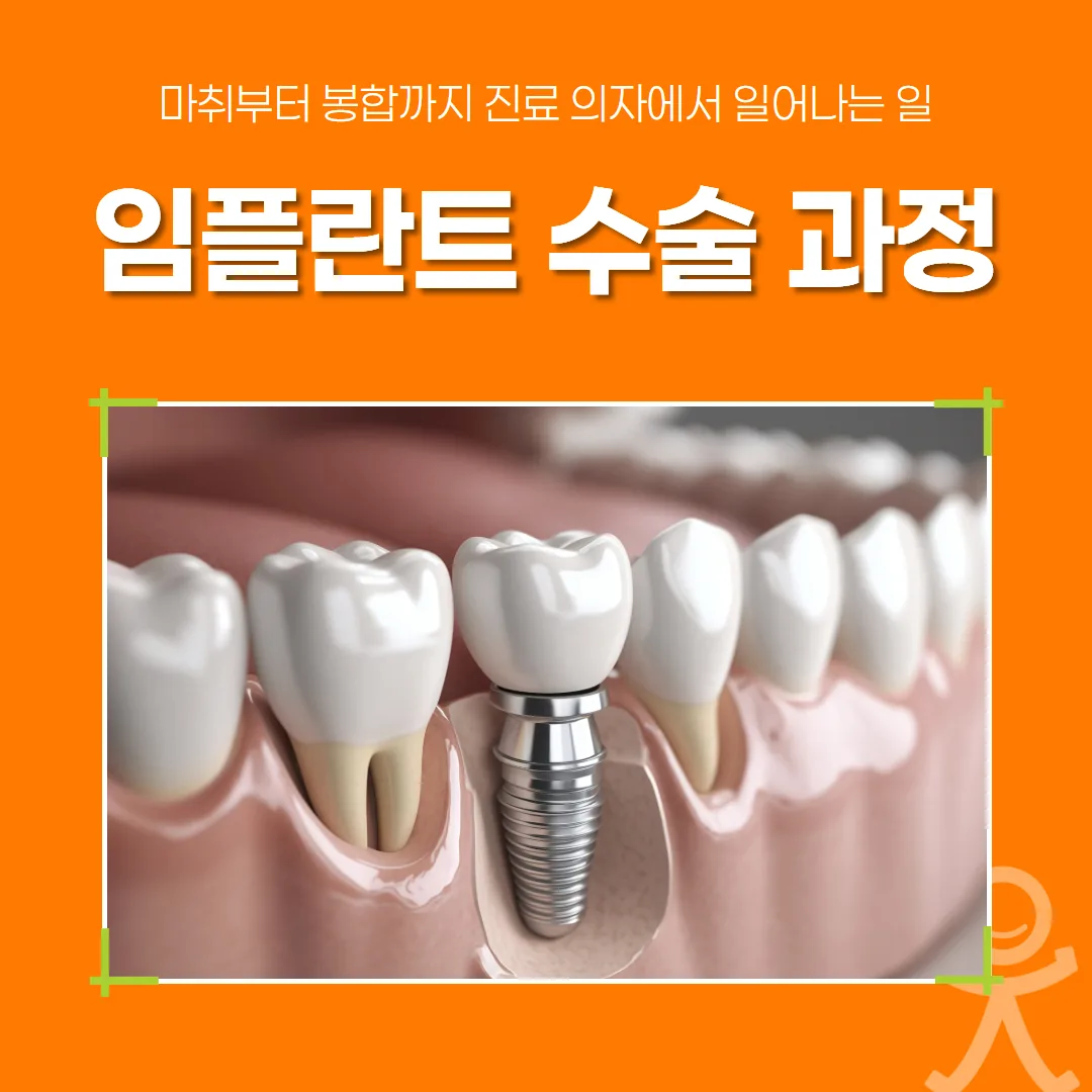임플란트 수술 과정, 마취부터 봉합까지 진료 의자에서 일어나는 일