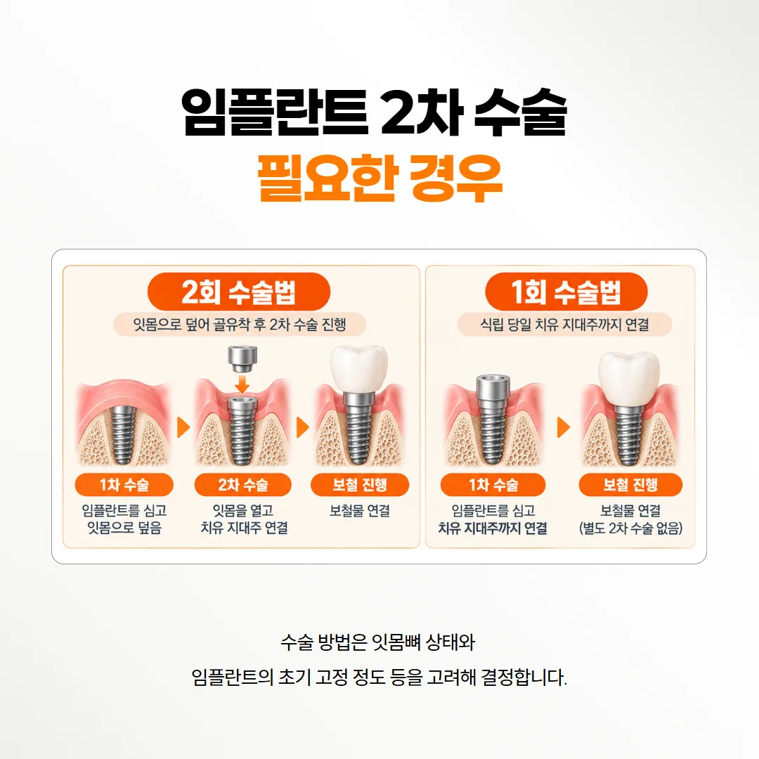 임플란트를 잇몸으로 덮어 두는 방법과 심은 날 기둥을 올리는 방법의 두 칸 비교 도식