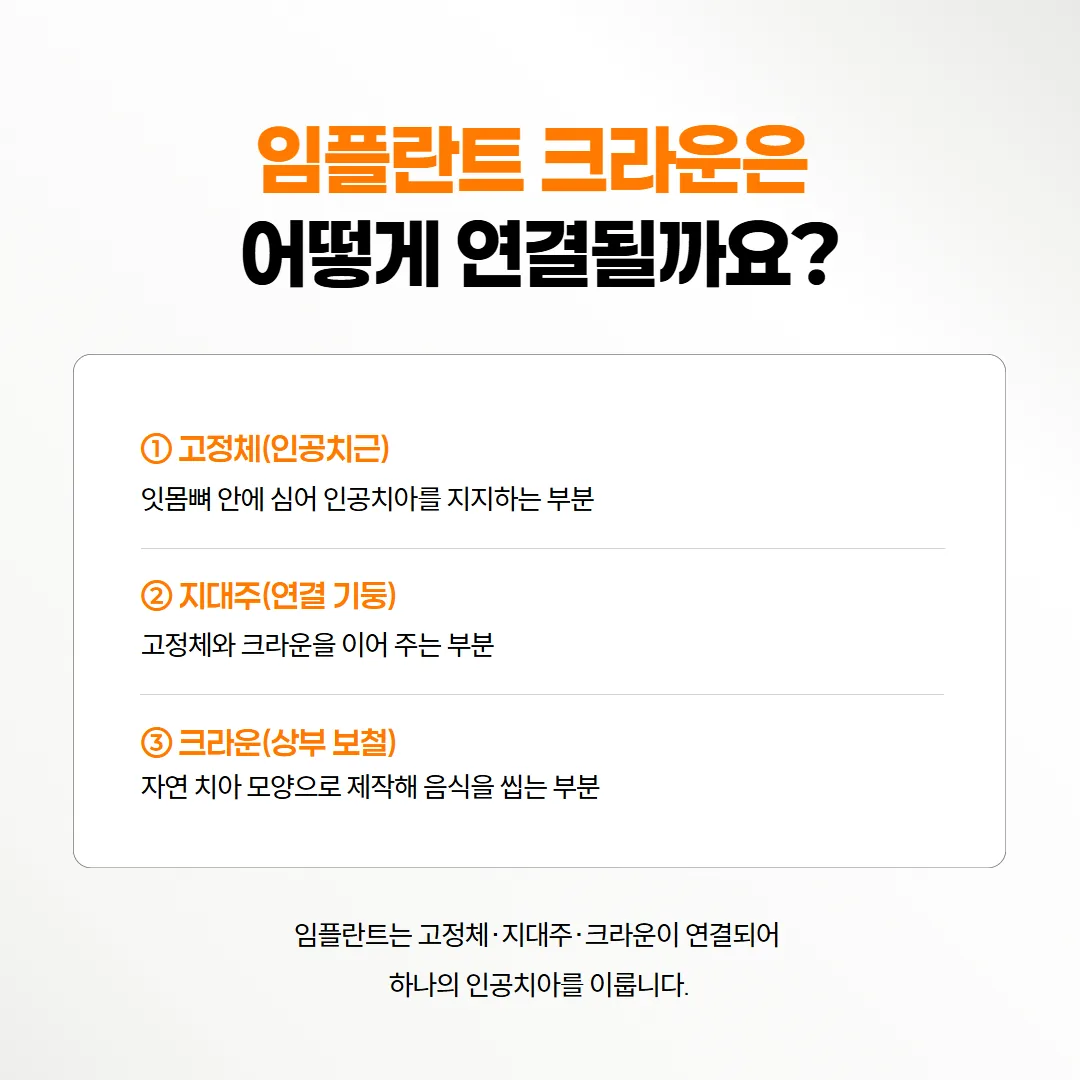 임플란트 뿌리와 연결 기둥, 크라운이 차례로 이어지는 구조를 옆에서 본 도식