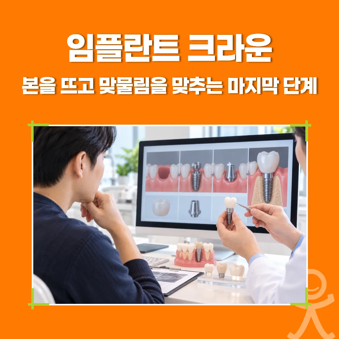 임플란트 크라운, 본을 뜨고 맞물림을 맞추는 마지막 단계